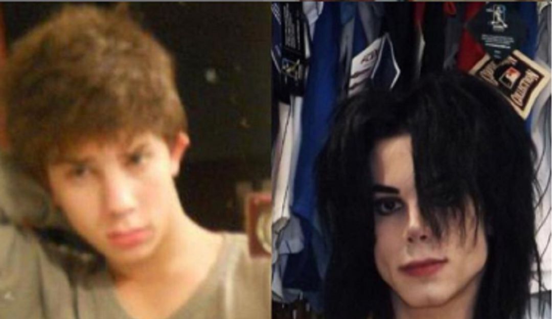La millonada que ha gastado este joven en cirugías para lucir como el "Rey: El Michael Jackson Argentino