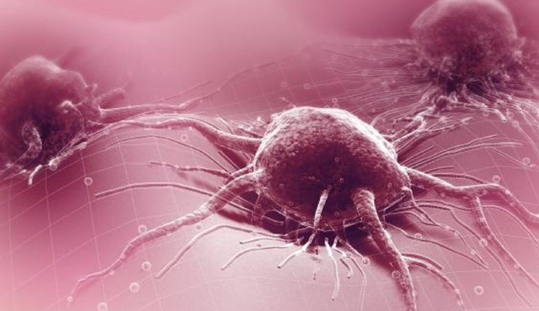 Tratamientos de Cáncer en Colombia: Colombia, un país de difícil acceso a tratamientos contra el cáncer
