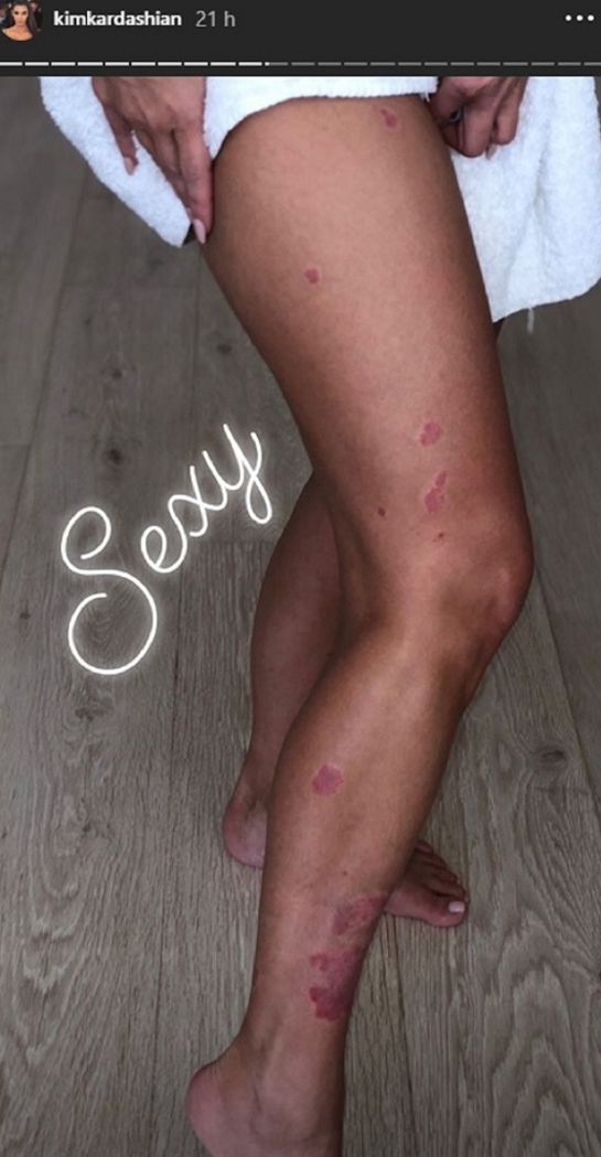 La magnate se dejó ver sin maquillaje y así reveló cómo la afecta su enfermedad. La magnate se dejó ver sin maquillaje y así reveló cómo la afecta su enfermedad.