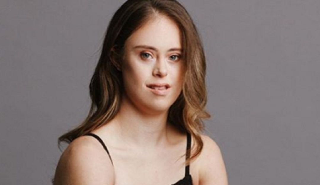 Modelo con Sindrome de Down: La increíble historia de modelo con Sindrome de Down que cautiva el mundo