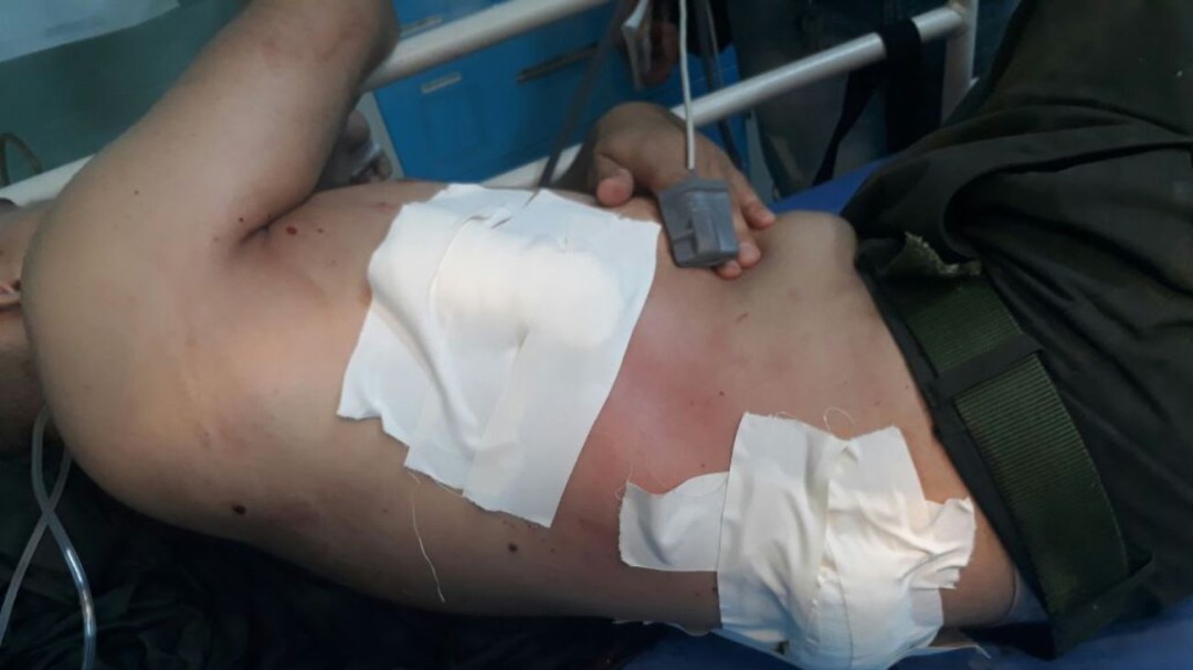 Taxista de Cartagena se salvó de morir a manos de unos asaltantes