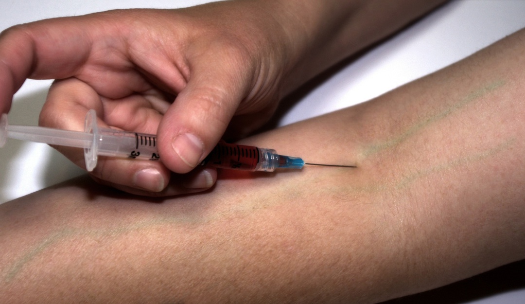 Virus del Papiloma Humano: ¿Qué hacer para prevenir el Virus del Papiloma Humano?