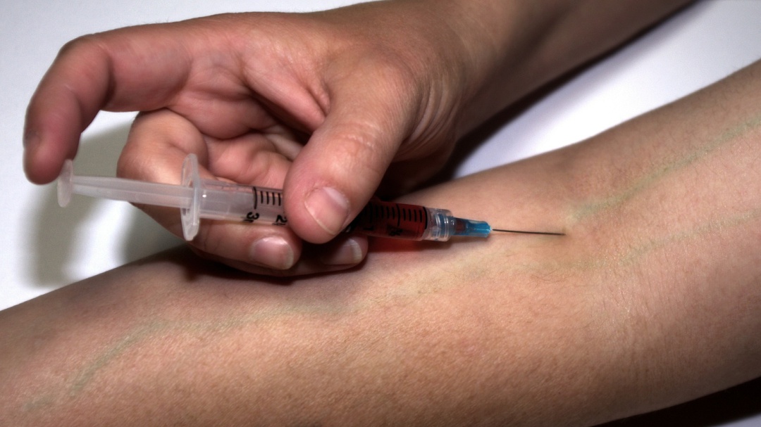 ¿Qué hacer para prevenir el Virus del Papiloma Humano?
