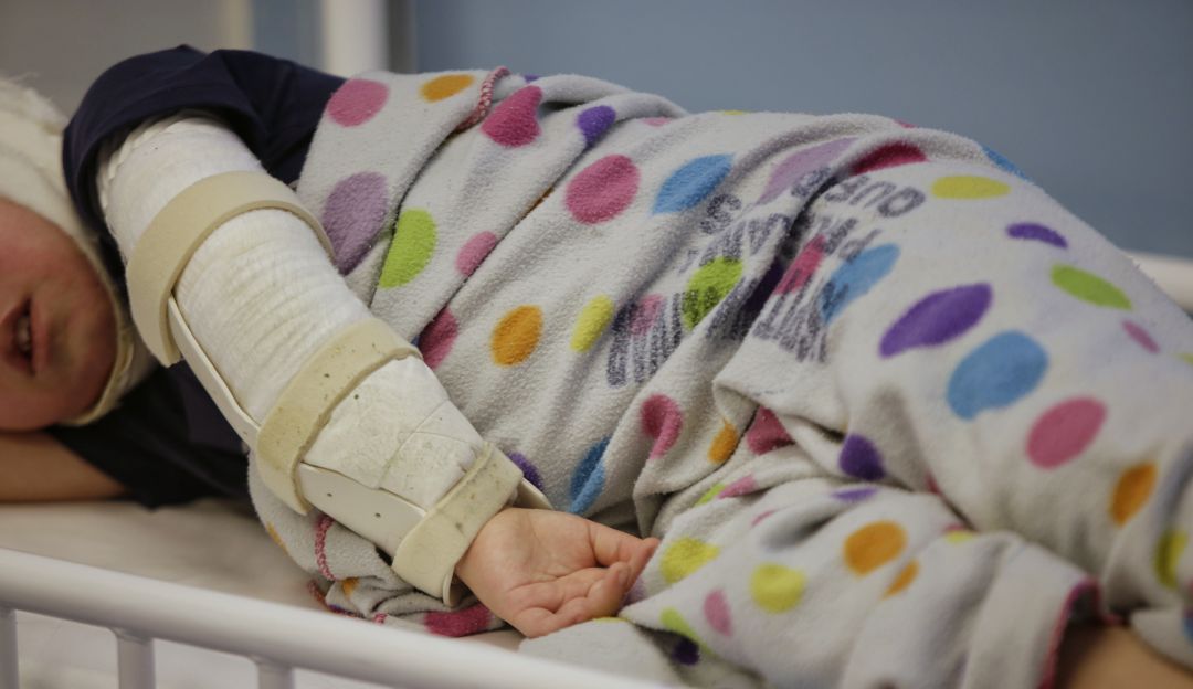 Menor quemado en Ibagué: Menor de 6 años sufrió quemaduras en 30% de su cuerpo