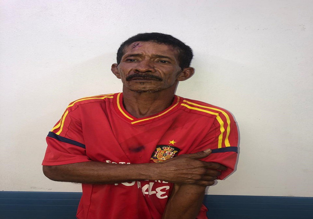 Un hombre roció ácido a su expareja y a su hija de 3 años