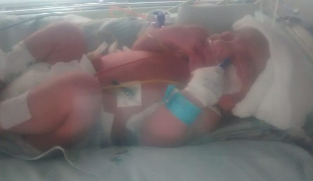 Un bebé recién nacido está en riesgo de morir por falta de atención médica