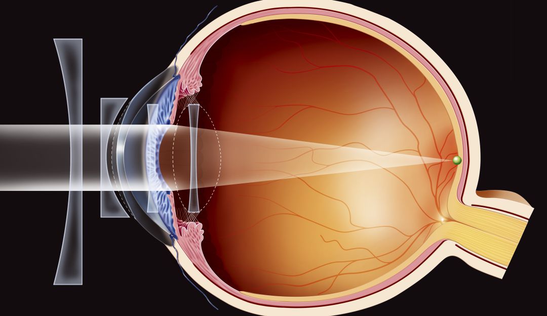 Problemas oculares: Un reto en redes revelaría sus problemas de visión