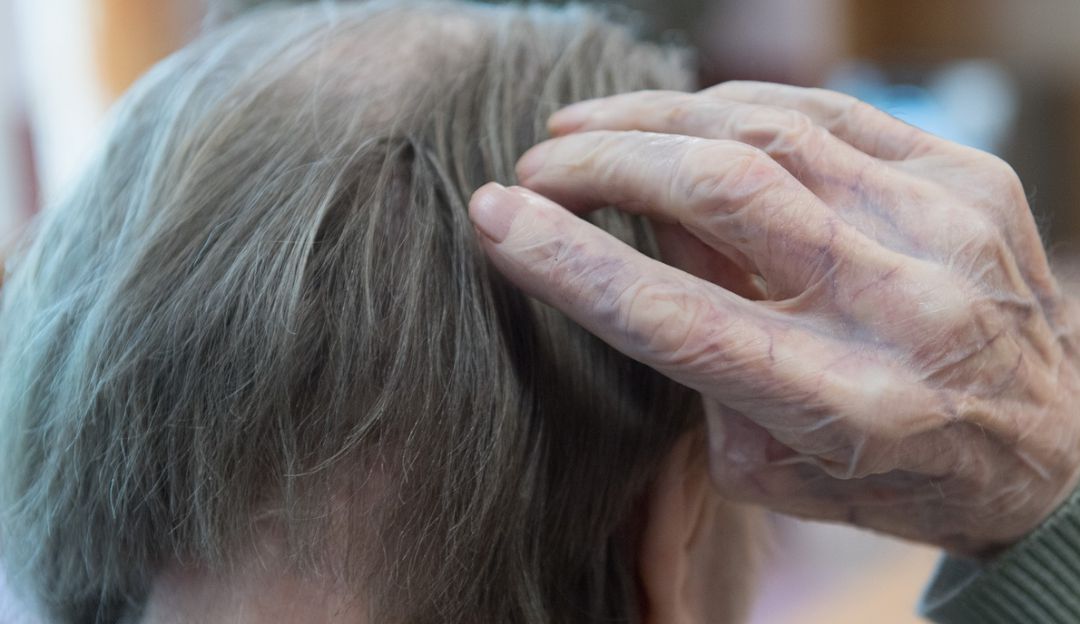 Casos de demencia: Los casos de demencia se triplicarán en el mundo hasta 2050, según la OMS