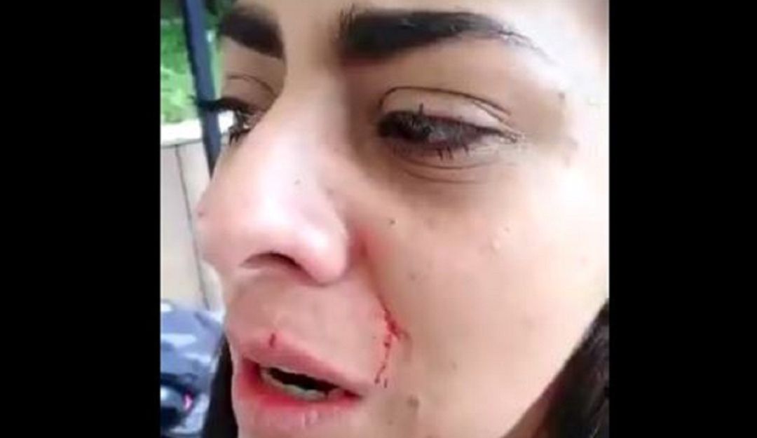 Periodista golpeada