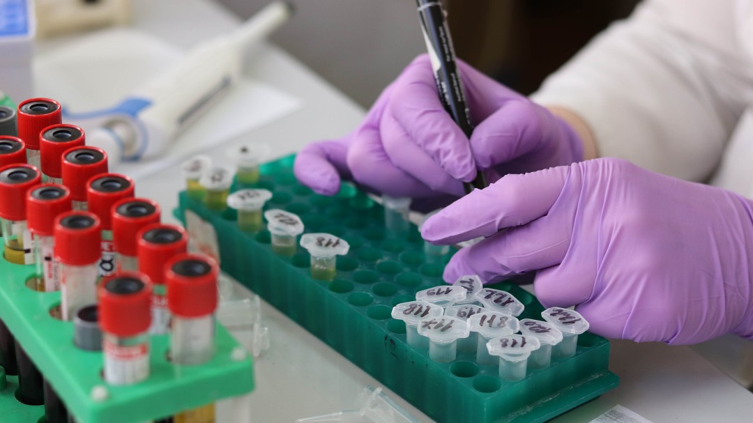 El estudio de los genes para la prevención del cáncer