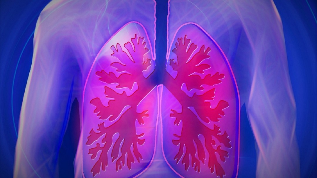 Tecnología que previene cáncer de pulmón con Inteligencia Artificial