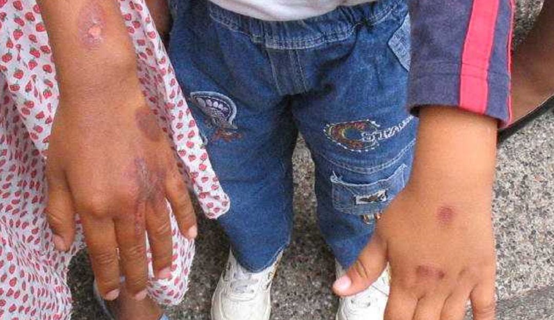 Día mundial contra la trata de personas: Una de cada cuatro víctimas por trata de personas es menor de edad: ONU