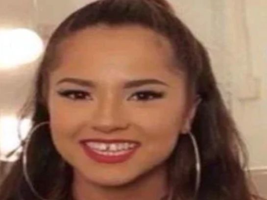 Así se veía Becky G con sus dientes originales Así se veía Becky G con sus dientes originales