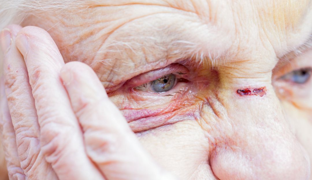 Maltrato a ancianos: A la cárcel por maltratar a su padre