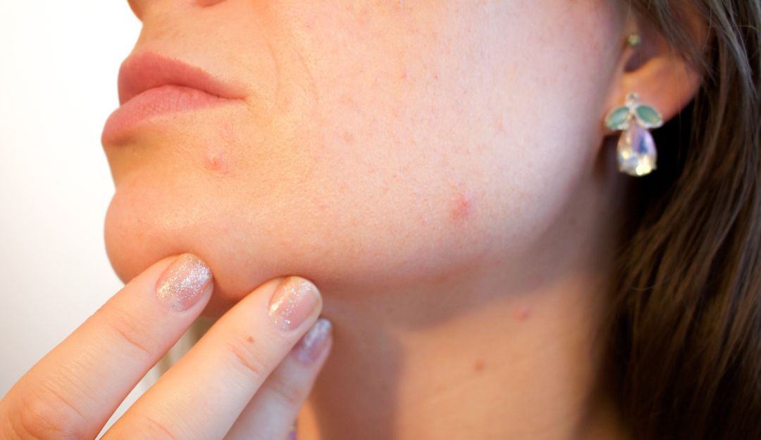 Cuidado corporal: Asocolderma prende las alarmas sobre cuidado de la piel