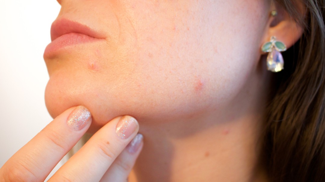 Asocolderma prende las alarmas sobre cuidado de la piel