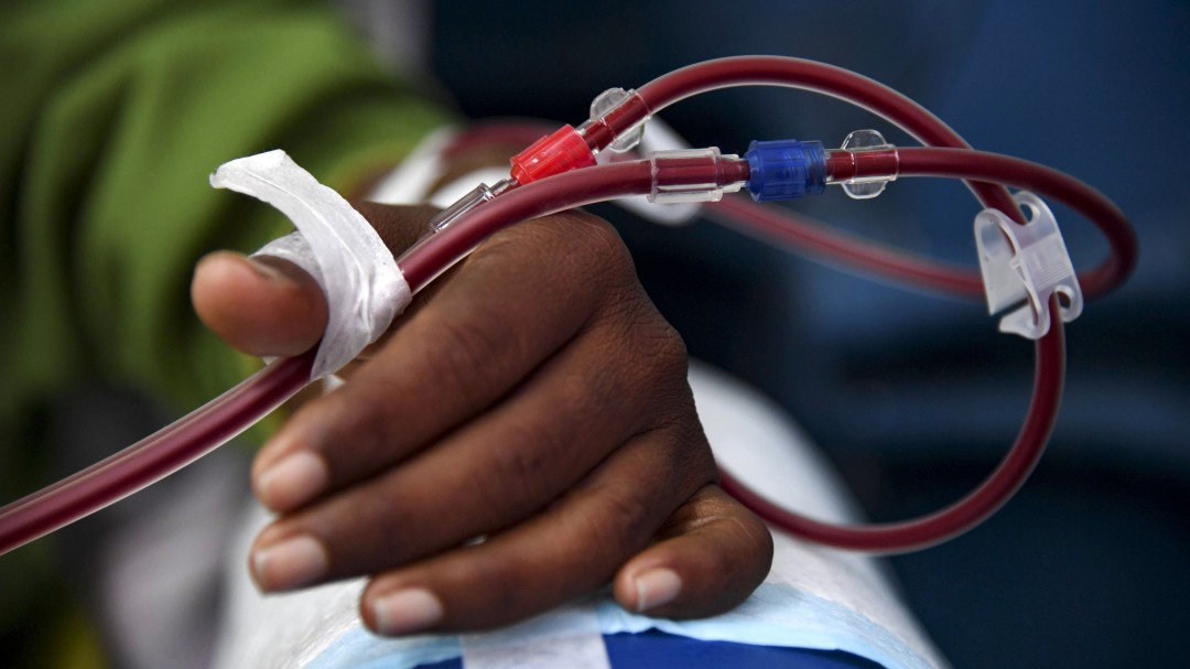 Francia salva vidas al transplantar riñones de personas viejas