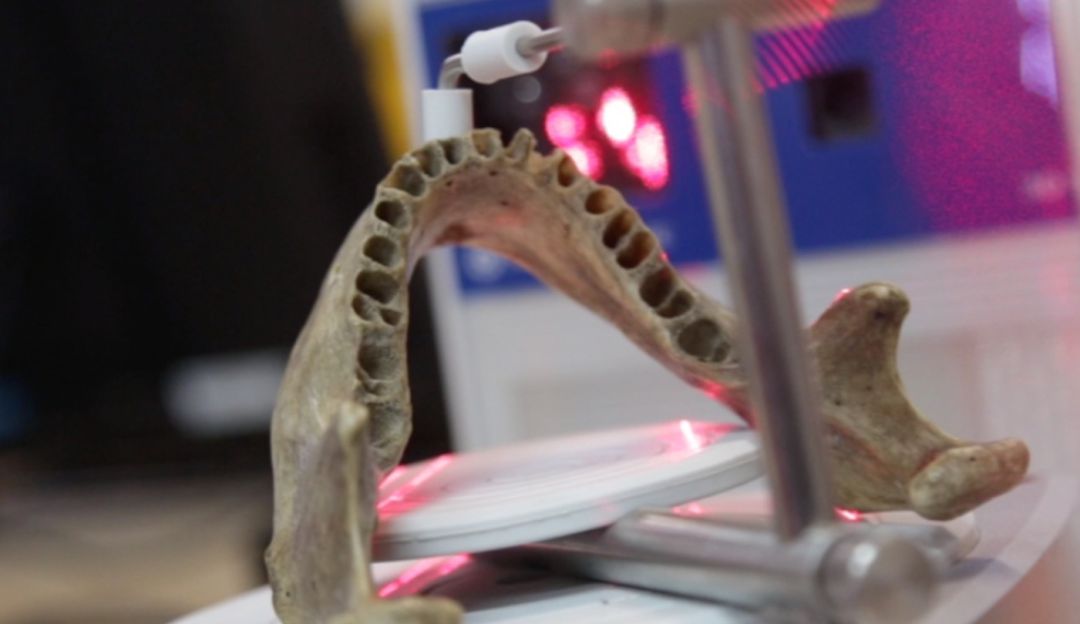 Ventajas impresión 3d, tecnología y salud: La impresión 3D y la salud se unen