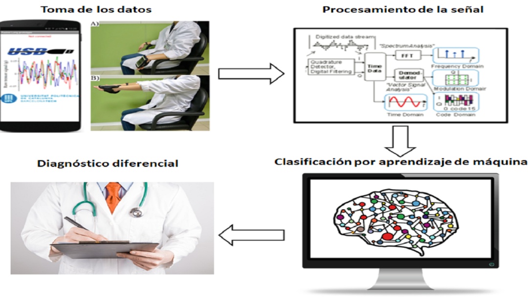 Diagnostico Párkinson: Una aplicación ayudará a diagnosticar el Párkinson