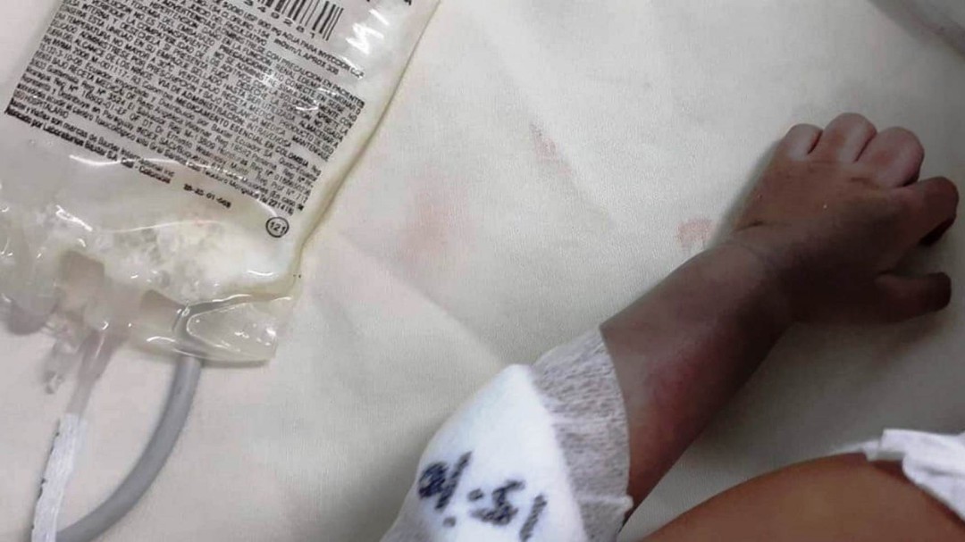 Autoridades de salud abren investigación por amputación a recién nacido