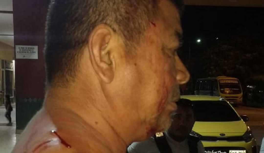 Taxista herido en Cartagena: Con arma blanca, hieren a taxista en Cartagena
