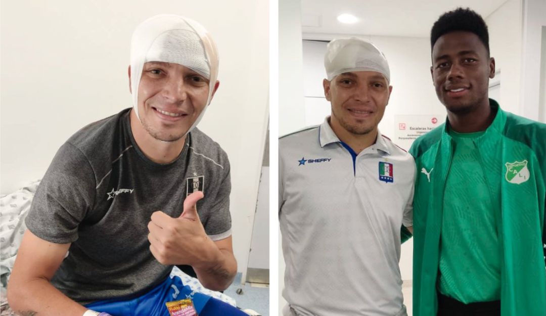 Andrés 'Pecoso' Correa tras su lesión en el partido con el Deportivo Cali