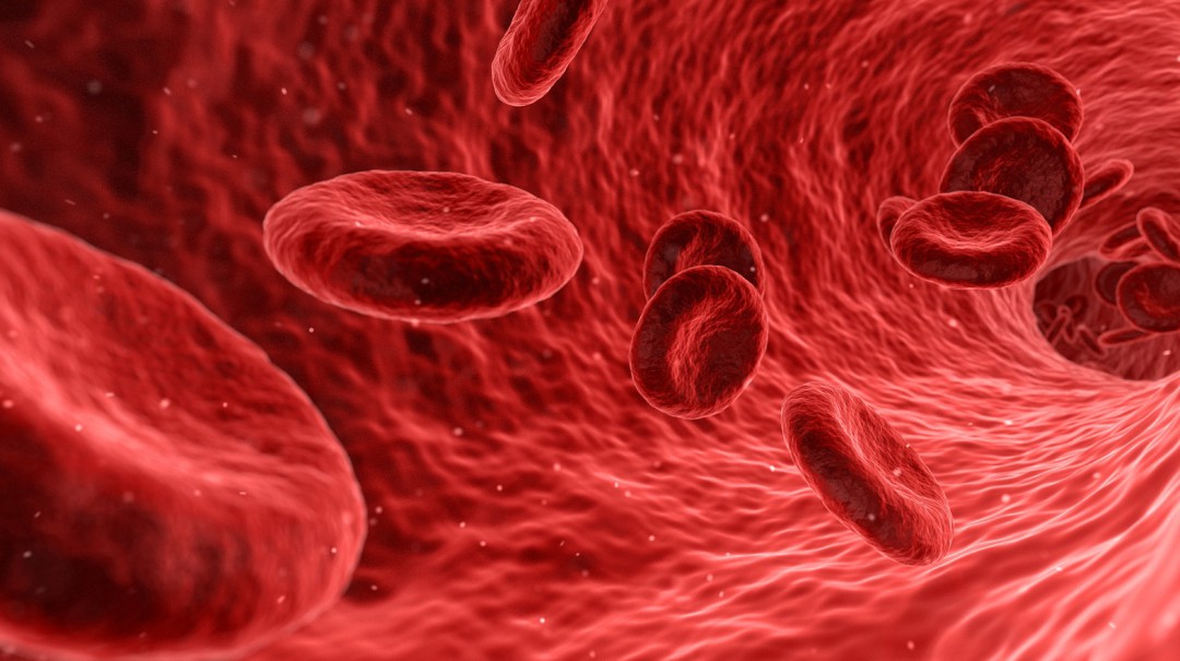 Leucemia linfocítica crónica: un invisible cáncer que corre por la sangre