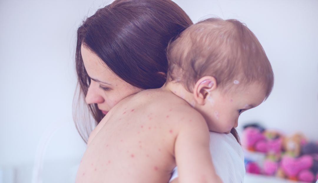 Boyacá primero superar cobertura vacuna contra Sarampión y Rubéola niños: Boyacá, primero en superar cobertura de vacuna contra Sarampión y Rubéola Boyacá primero superar cobertura vacuna contra Sarampión y Rubéola niños: Boyacá, primero en superar cobertura de vacuna contra Sarampión y Rubéola