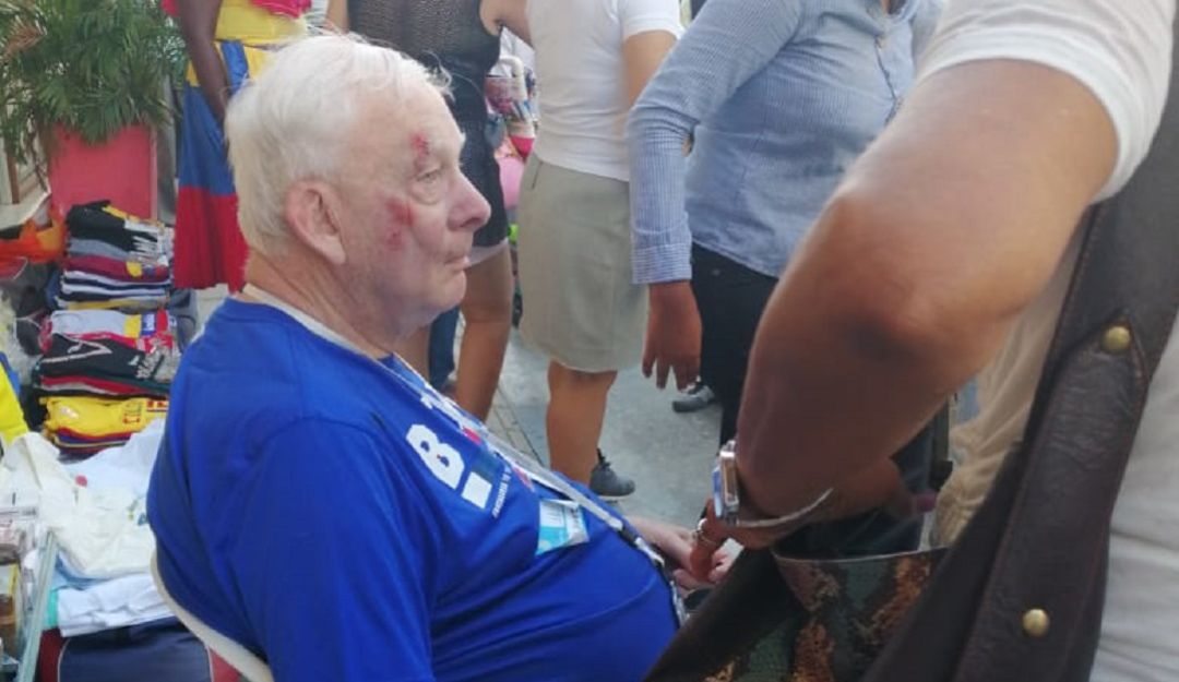 Extranjero herido coche turístico Cartagena: Extranjero resultó herido al ser golpeado con un coche turístico Cartagena