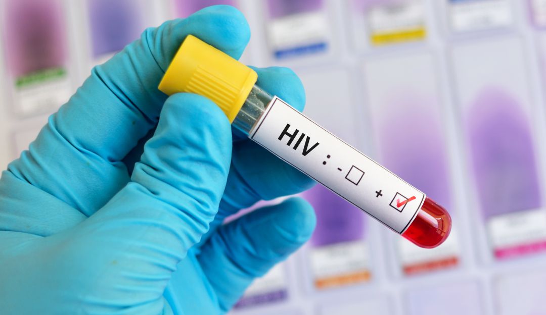 Casos Sida: En Caldas piden no bajar la guardia para prevenir el VIH/Sida