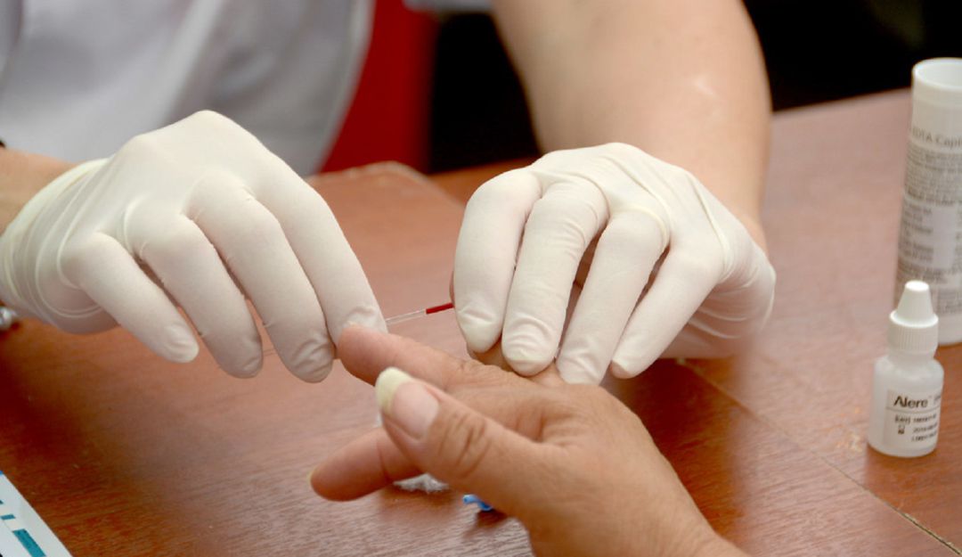 Casos de Sida: Aumentan los contagios pero disminuyen las muertes por VIH en Pereira