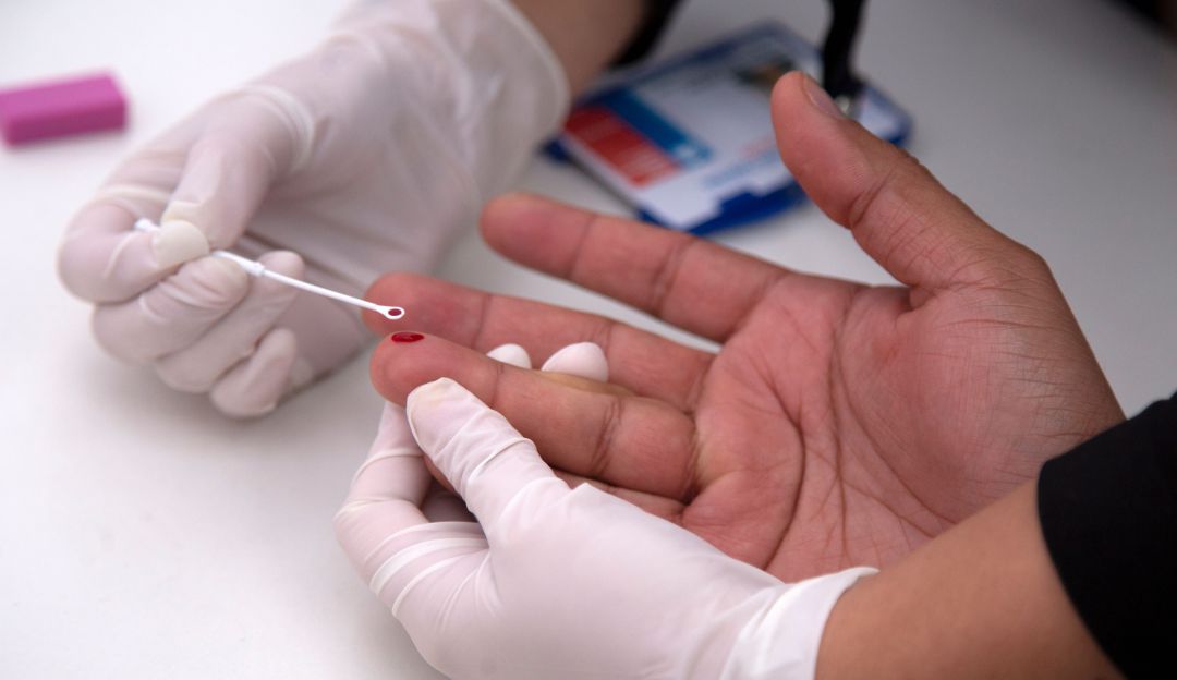 Censo sobre VHI en Antioquia: En Antioquia hay 2.500 personas contagiadas con VIH SIDA