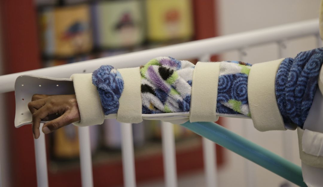 Quemados con pólvora: Nariño ya tiene dos quemados con pólvora en Navidad