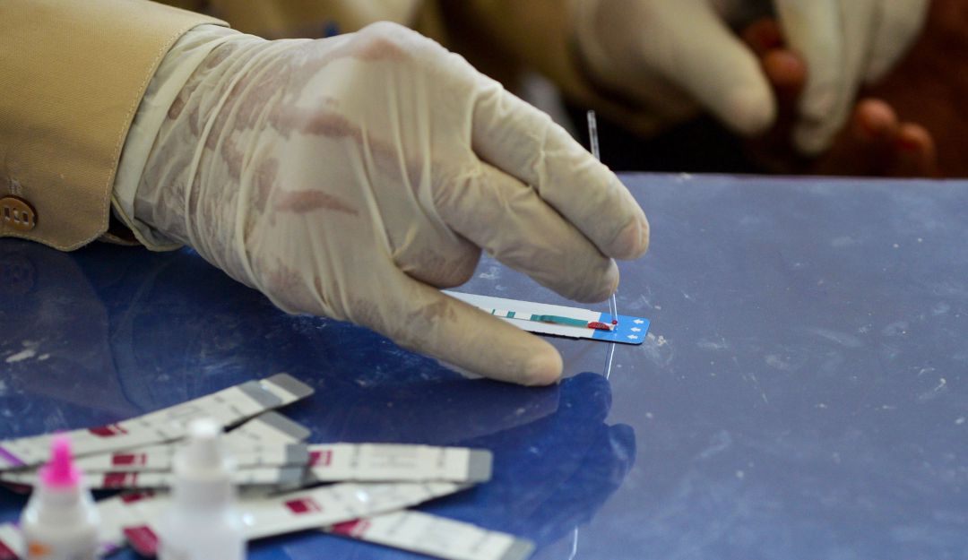Exámenes de VIH y sífilis en Bogotá: Más de 19.500 pruebas para VIH y sífilis se realizaron en Bogotá
