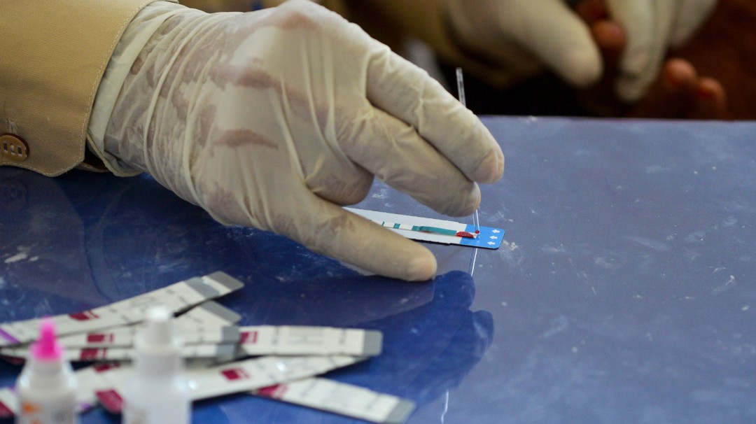 Más de 19.500 pruebas para VIH y sífilis se realizaron en Bogotá