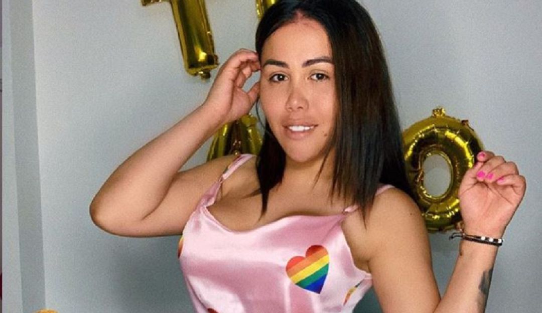 Yina Calderón se realizó la gluteoplastia: ¡De nuevo al quirófano! Yina Calderón muestra su aumento de glúteos