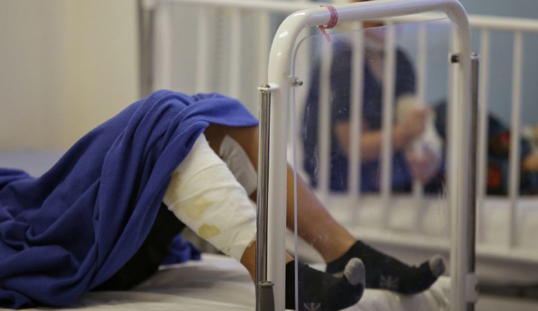 Quemados con pólvora: Seis adultos quemados con pólvora y un menor intoxicado en Noche de Velitas
