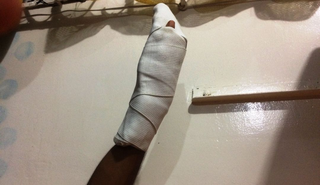Velitas en Cartagena: Dos personas quemadas con pólvora durante Las Velitas en Cartagena
