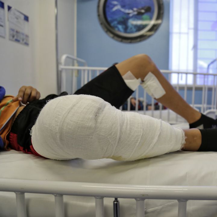 Reportan en Cauca 11 casos de lesionados con pólvora
