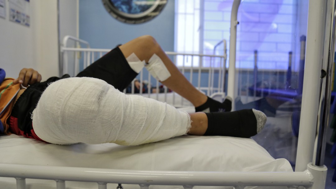 Reportan en Cauca 11 casos de lesionados con pólvora