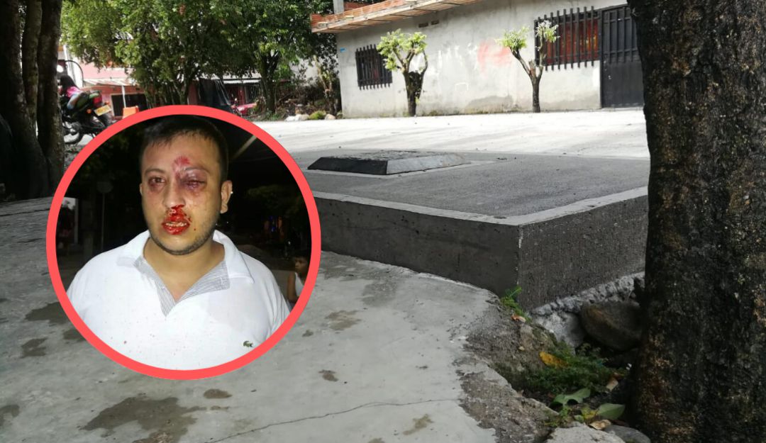 AGRESION BRUTAL OBRAS DENUNCIA LIDER SOCIAL: Líder social denuncia agresión por reclamar demora en obra vial