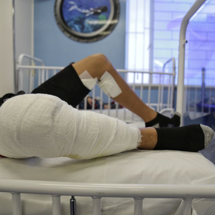 Alerta por el aumento de personas quemadas con pólvora