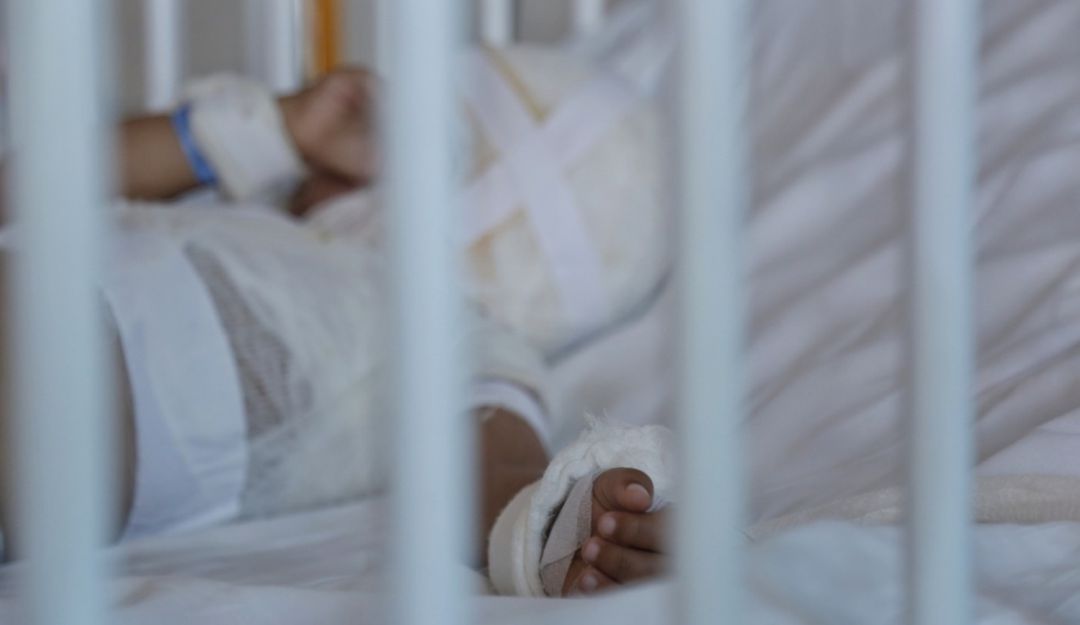 Quemados con pólvora en Risaralda: Otro menor de edad resultó quemado con pólvora en Risaralda