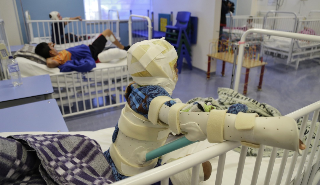 Cifras quemados pólvora Colombia: ¡Cuidado! Aumentan cifras de quemados con pólvora en Colombia