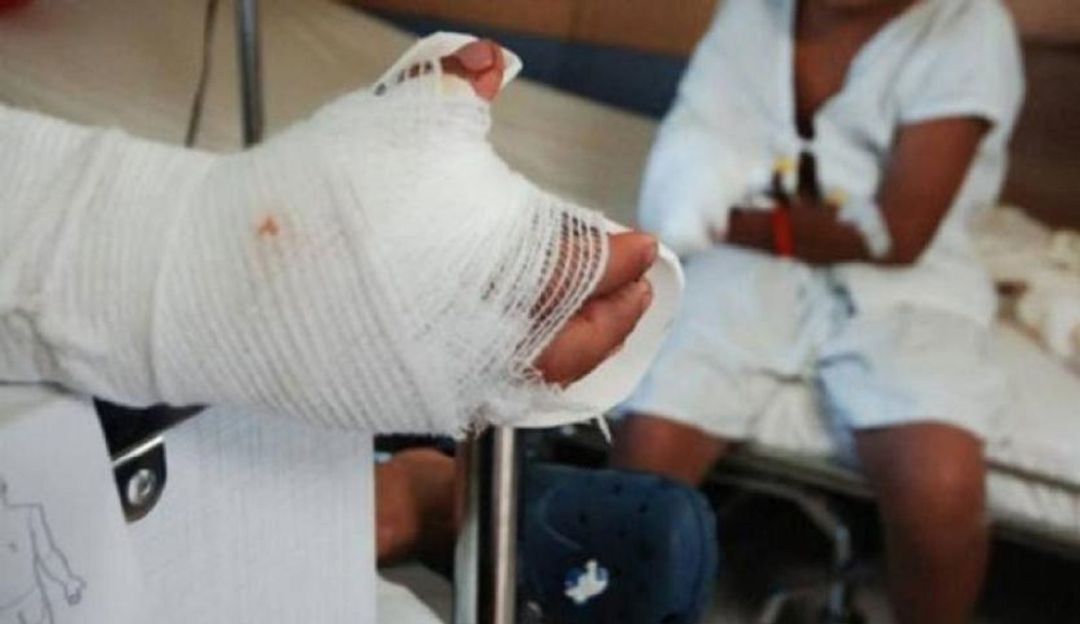 Quemados, pólvora, Medellín: Dos niñas, las primeras quemadas con pólvora en Medellín