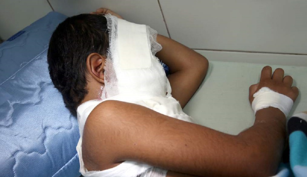 Quemados con pólvora en Cúcuta: A once aumenta el número de quemados en Norte de Santander durante navidad