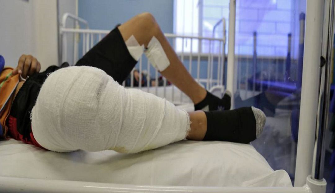 Quemados en el Atlántico por pólvora: Menor venezolano resultó lesionado durante fin de año en Malambo, Atlántico