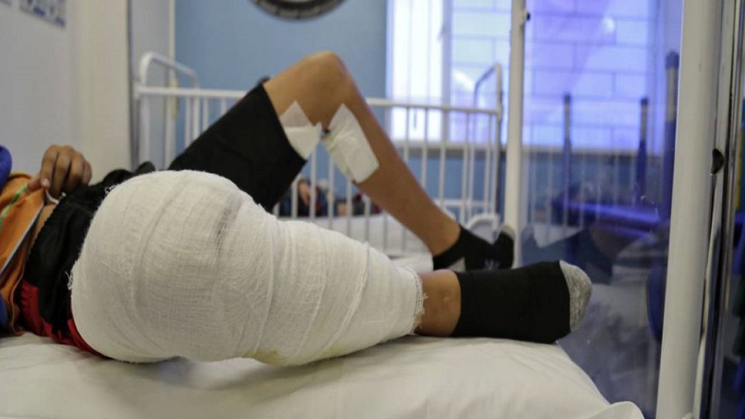 Menor venezolano resultó lesionado durante fin de año en Malambo, Atlántico
