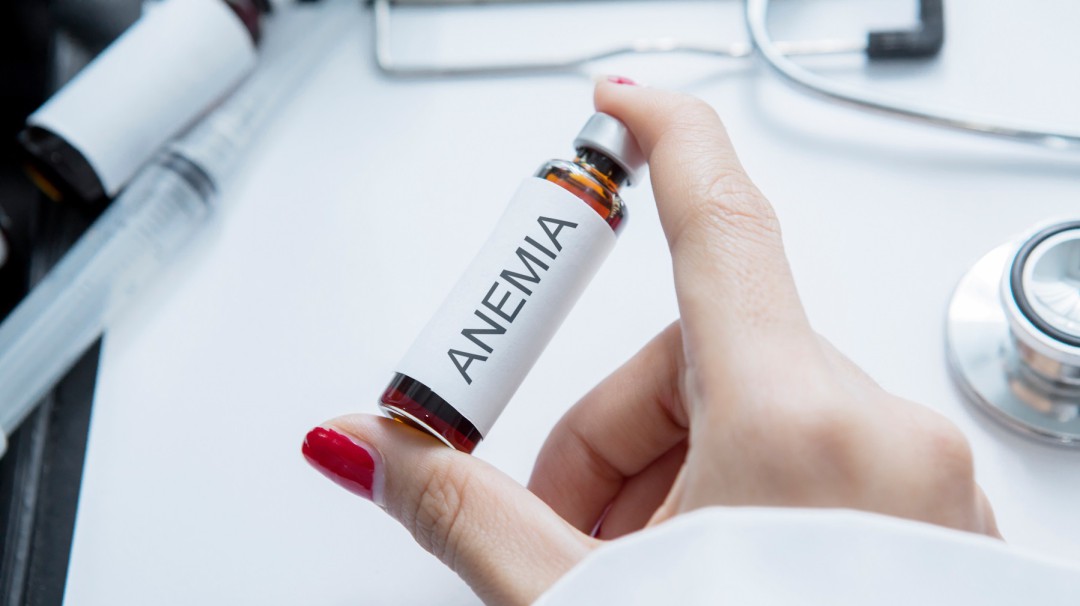 Una aplicación móvil mediría el nivel de anemia en niños