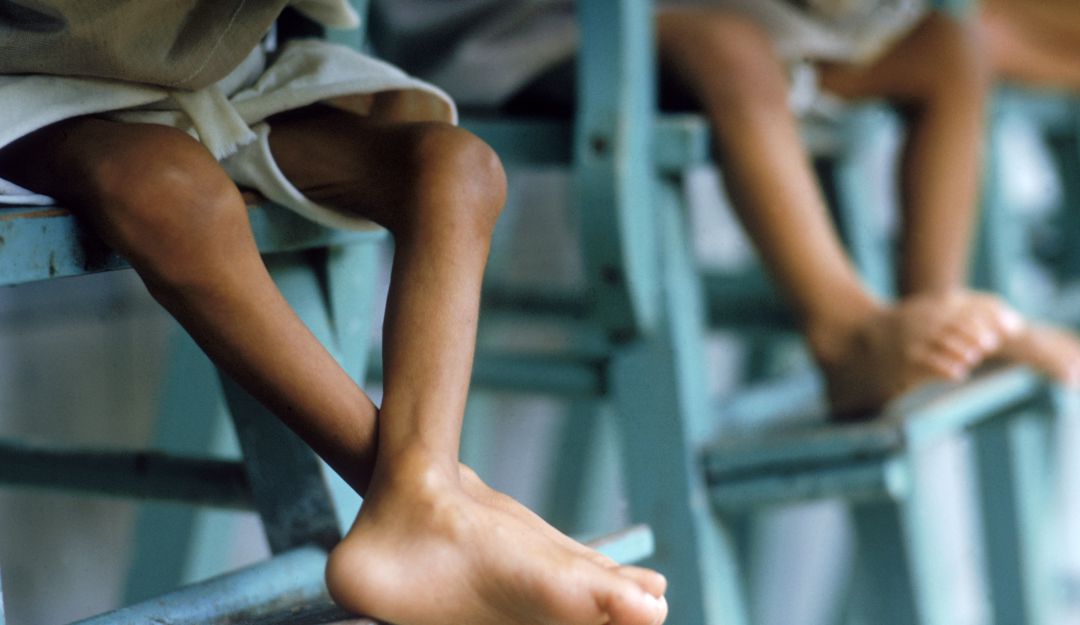 En Colombia los niños mueren de hambre: En Colombia siguen muriendo niños por falta de alimentación